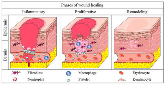 Skin wound repair